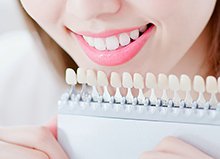 ホワイトニングの種類のイメージ