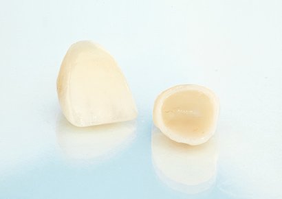 被せ物による修復 イメージ