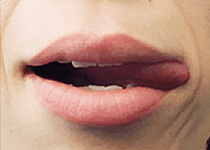 舌の筋肉をきたえよう