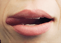 舌の筋肉をきたえよう