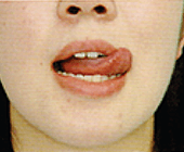 舌の筋肉をきたえよう