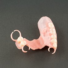 ノンクラスプデンチャー イメージ