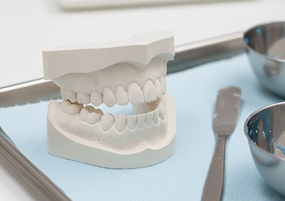 型取りのイメージ