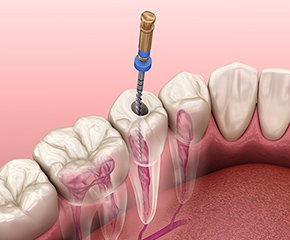 トピックス_06 イメージ1