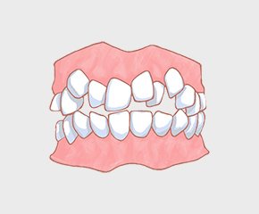 叢生（そうせい）