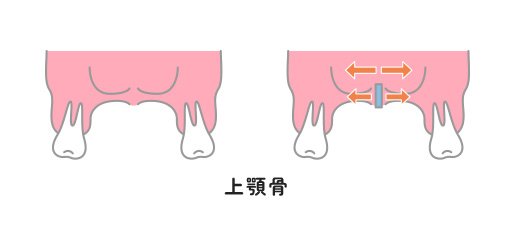 歯並びの土台から整えるSH療法