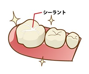 シーラントのイメージ