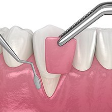 リグロス イメージ