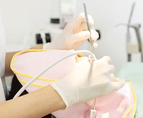 歯周病治療のイメージ